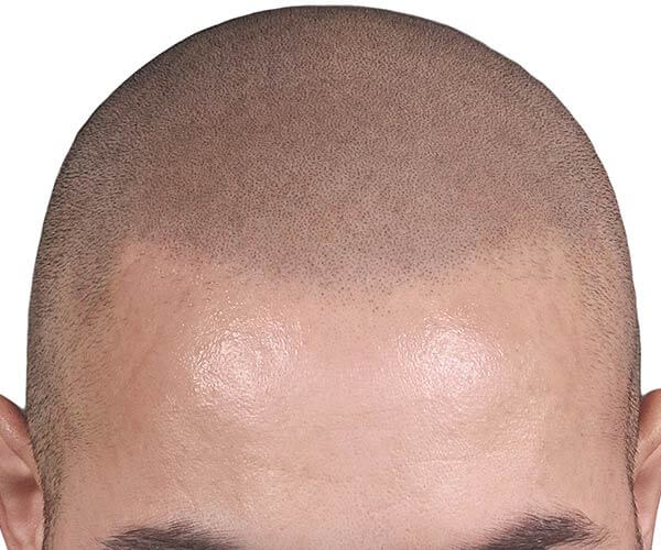114349817348015577.jpg