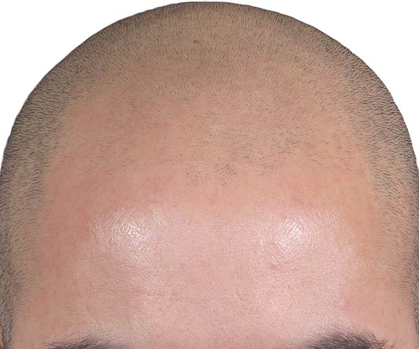 709188476852883849.jpg